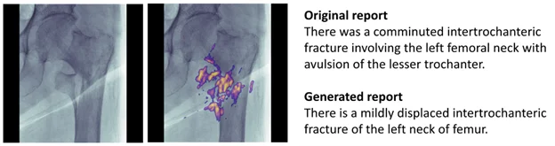 Two pelvic x-rays comparing the original report and the generated report.
